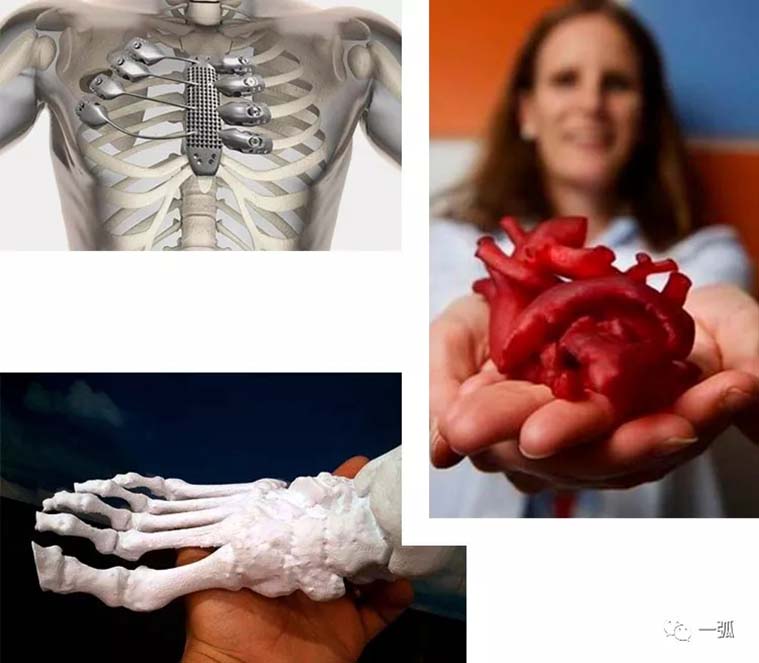 3D打印器官